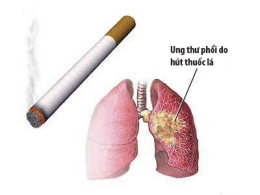 Hút thuốc lá và những nguy cơ về bệnh ung thư phổi